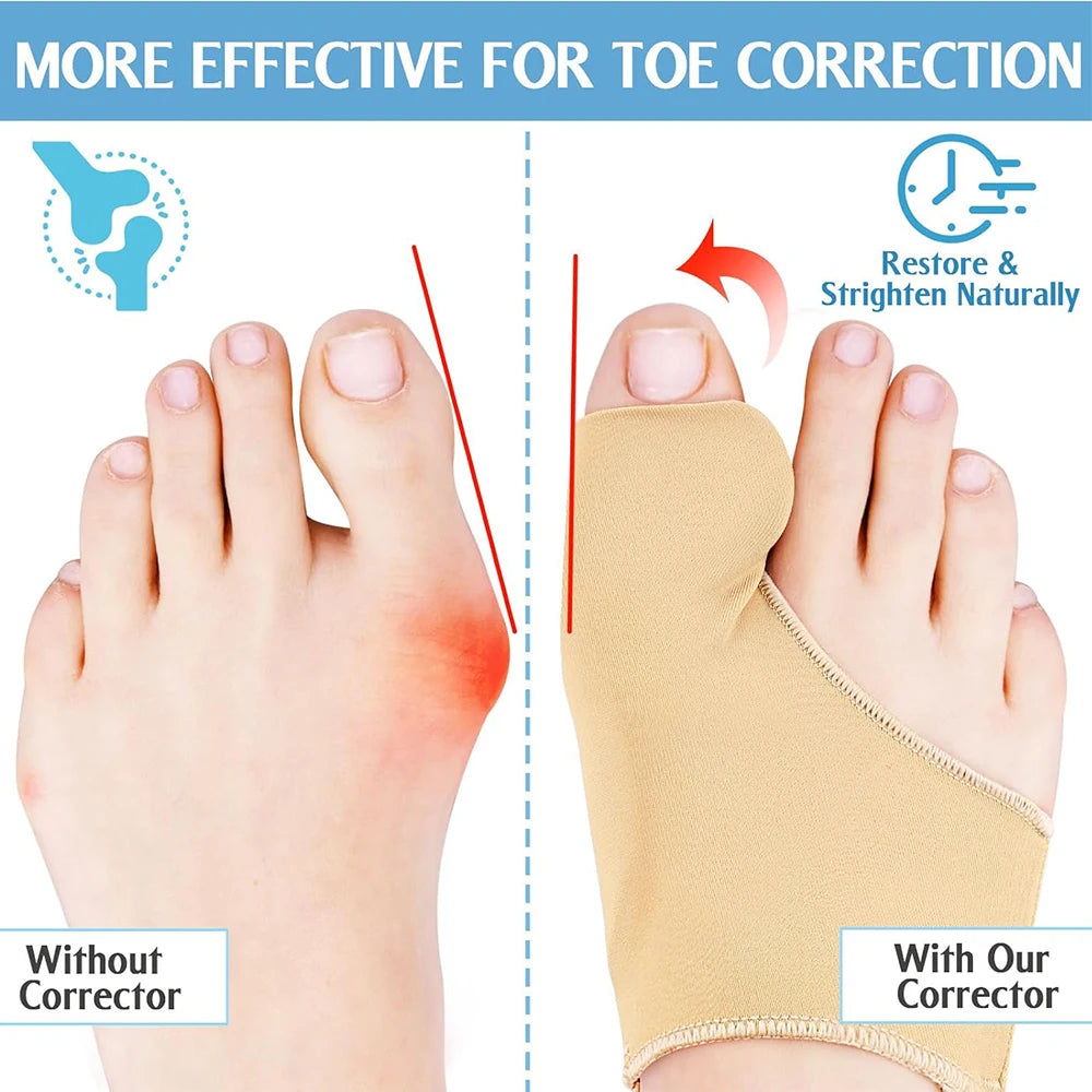 Bunion Corrector Halux Valgus Corrector Bunions Corrector For Women Toe Separator Foot Finger Separators Hallux Valgus Corrector