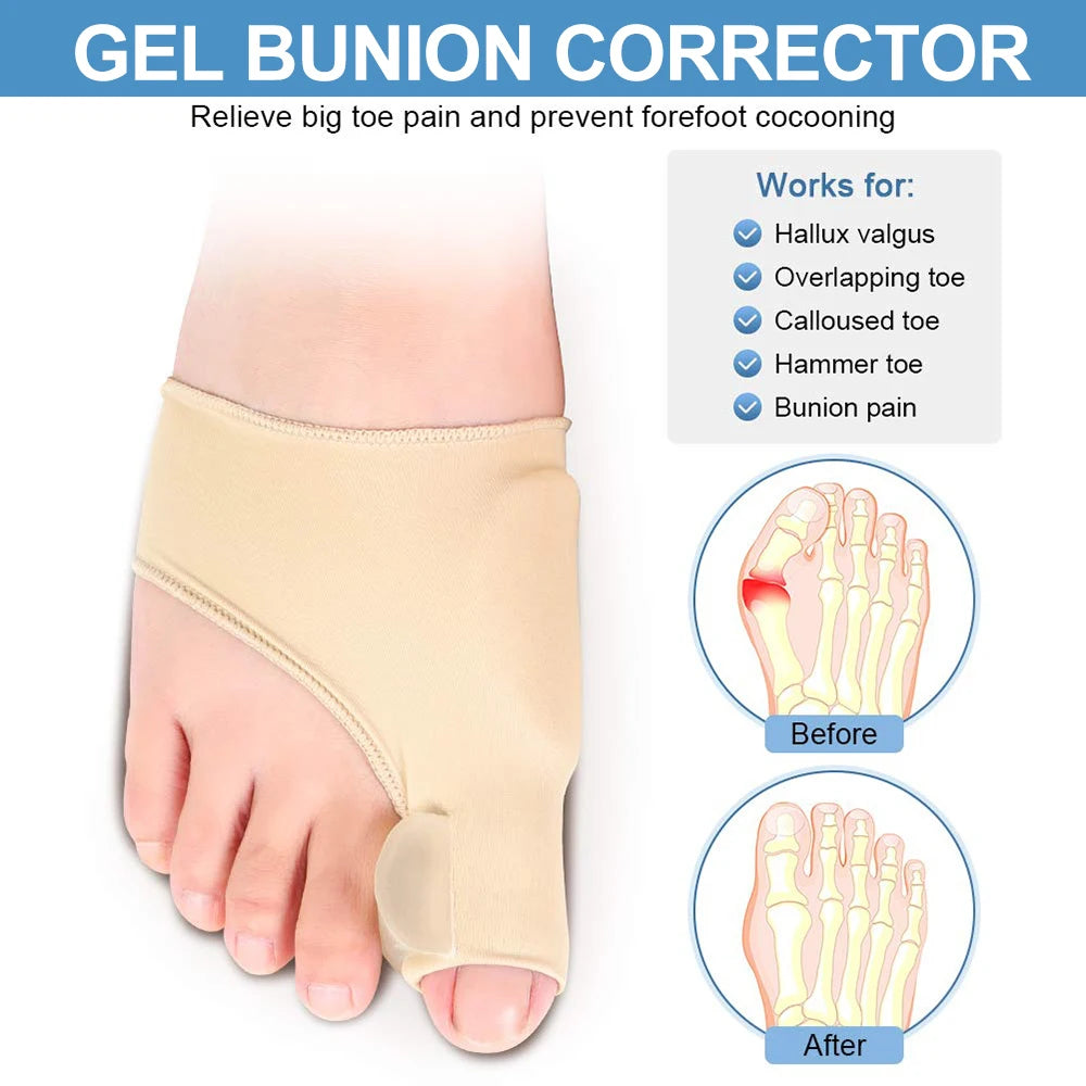 Bunion Corrector Halux Valgus Corrector Bunions Corrector For Women Toe Separator Foot Finger Separators Hallux Valgus Corrector